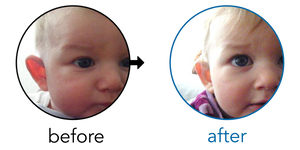 Before-and-after EarBuddies Stick-Out Ears result; started at 1–3 months – Sofia & her Daughter