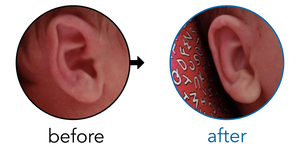 Before-and-after EarBuddies Folded-Over Helical Rim result; started within the first month – Mrs. B & her Baby Son