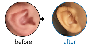 Before-and-after EarBuddies Lop Ear result; started within the first month – Jacquelyn & her Daughter Avery
