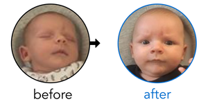 Before-and-after EarBuddies Stick-Out Ears result; started within the first month – James & his Son