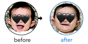 Before-and-after EarBuddies Stick-Out Ears result; started at 3–6 months – Alexandra & her Daughter Julia