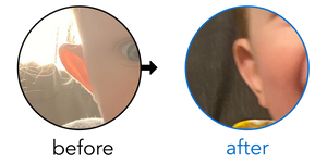 Before-and-after EarBuddies Stick-Out Ears result; started at 3–6 months – Luise & her son Tallan