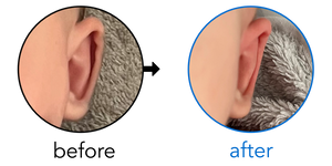 Before-and-after EarBuddies Stick-Out Ears result; started at 1–3 months – Sofia & her son