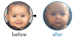 Before-and-after EarBuddies Stick-Out Ears result; started at 6–12 months – Amreen & her Daughter