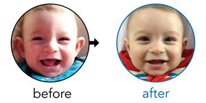 Before-and-after EarBuddies Stick-Out Ears result; started at 3–6 months – Cristina & her Son Santi