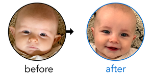 Before-and-after EarBuddies Stick-Out Ears result; started at 1–3 months – Kinzie & her Daughter Tess