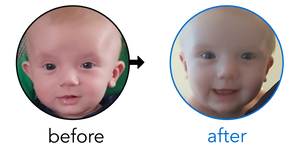 Before-and-after EarBuddies Stick-Out Ears result; started at 1–3 months – Julia & her Son Ralph