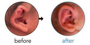 Before-and-after EarBuddies Stahl's Bar result; started within the first month – Jessica, Blaine & their Son Connor