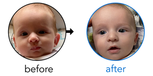 Before-and-after EarBuddies Stick-Out Ears result; started at 1–3 months – Samantha & her Son Zachary