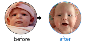 Before-and-after EarBuddies Stick-Out Ears result; started at 1–3 months – Kelly & her Daughter Blaire