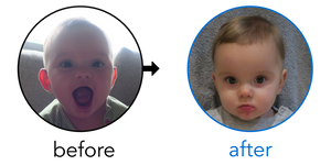 Before-and-after EarBuddies Stick-Out Ears result; started at 3–6 months – Alyssa & her Daughter