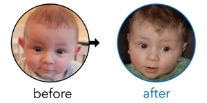 Before-and-after EarBuddies Stick-Out Ears result; started at 1–3 months – Amy & her Son Tyler