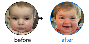 Before-and-after EarBuddies Stick-Out Ears result; started at 3–6 months – Jasmine & her daughter