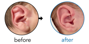 Before-and-after EarBuddies Stahl's Bar result; started within the first month – Gary & his son