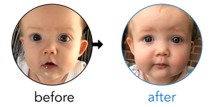 Before-and-after EarBuddies Stick-Out Ears result; started at 3–6 months – Helen & her Daughter Hannah