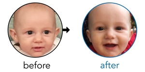 Before-and-after EarBuddies Stick-Out Ears result; started at 3–6 months – Amber & her Son Wolfie