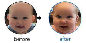 Before-and-after EarBuddies Stick-Out Ears result; started at 3–6 months – Kate & her Daughter Elise