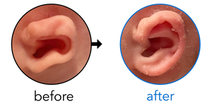 Before-and-after EarBuddies Stick-Out Ears result; started at 1–3 months – Coady & her son Jude
