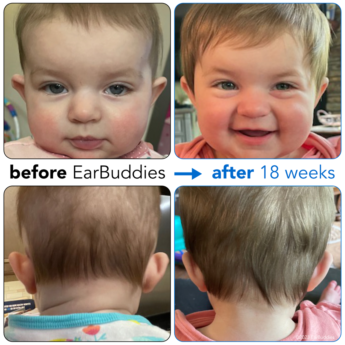 Second Earbuddies(TM) tape change – the challenging one!