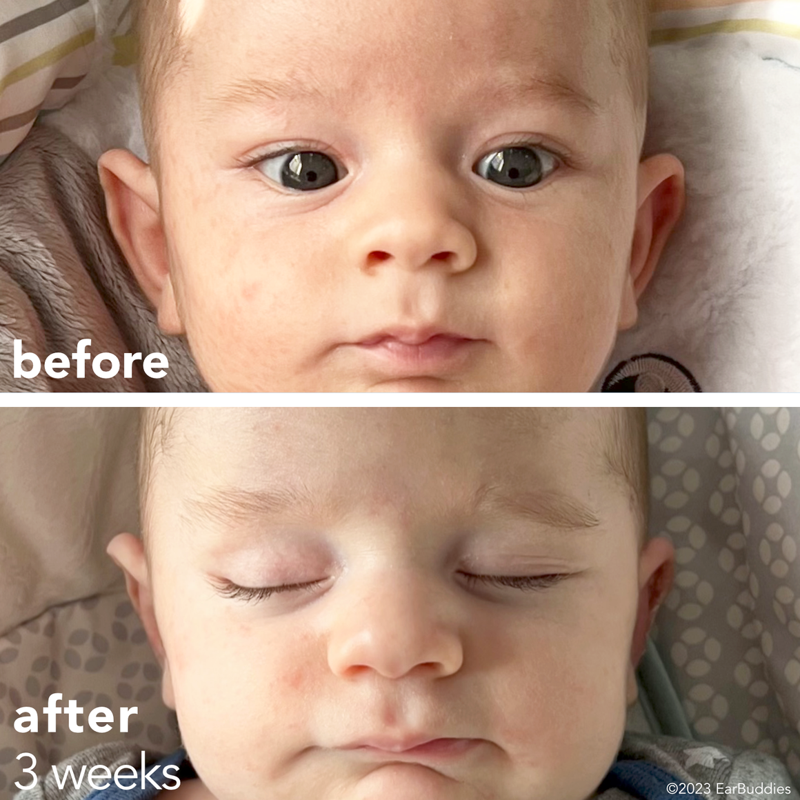 Baby ear online folding while sleeping