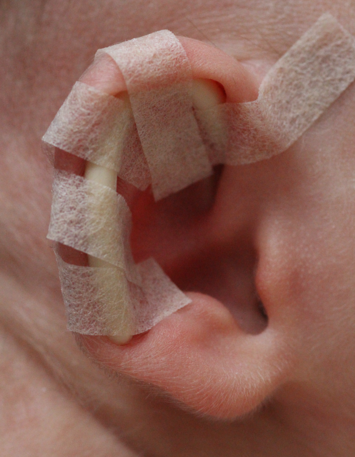 How it works – EarBuddies