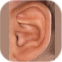 Inner Ear Rims How it works – EarBuddies